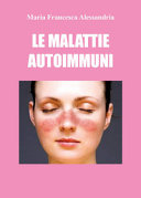 MALATTIE AUTOIMMUNI
